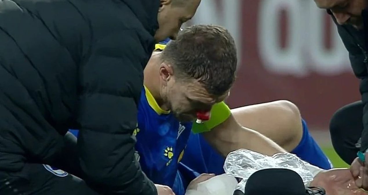 Edin Dzeko, Romanya maçı tamamlayamadı