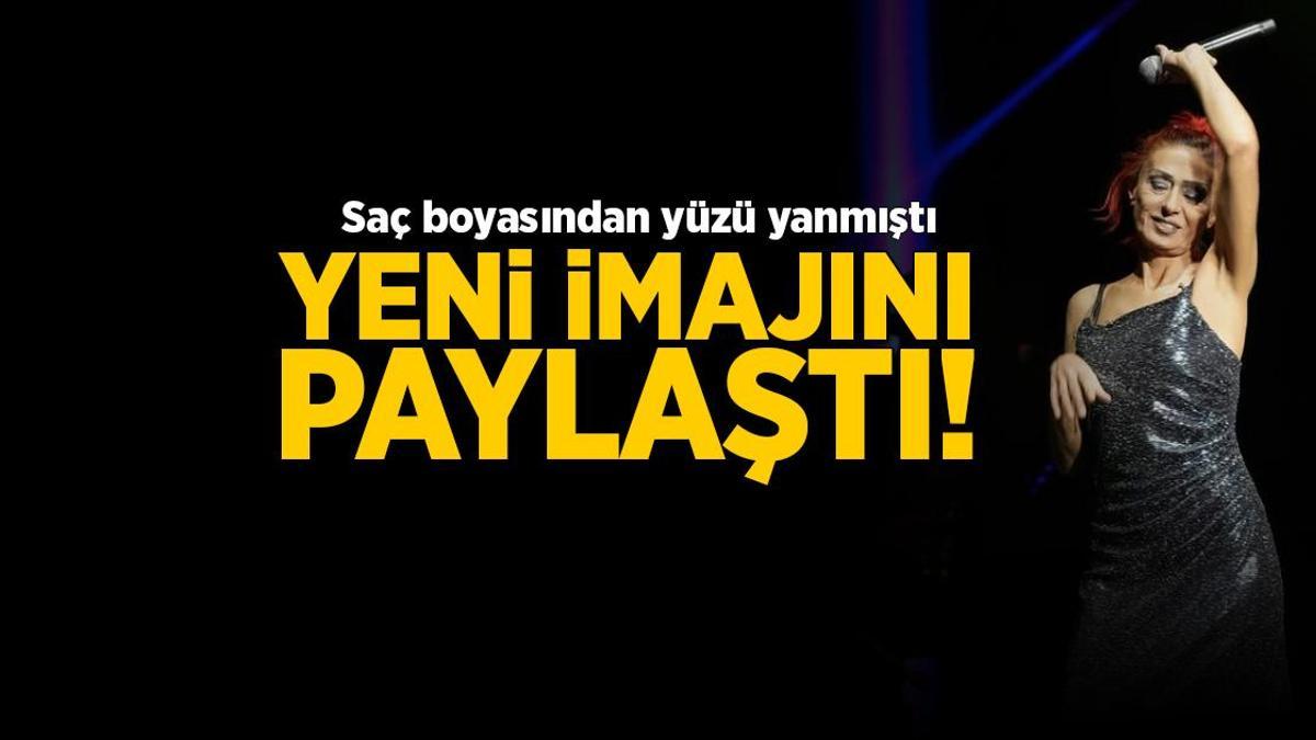 Yıldız Tilbe yeni imajını paylaştı! ‘Yaralarım geçmeyecekti’